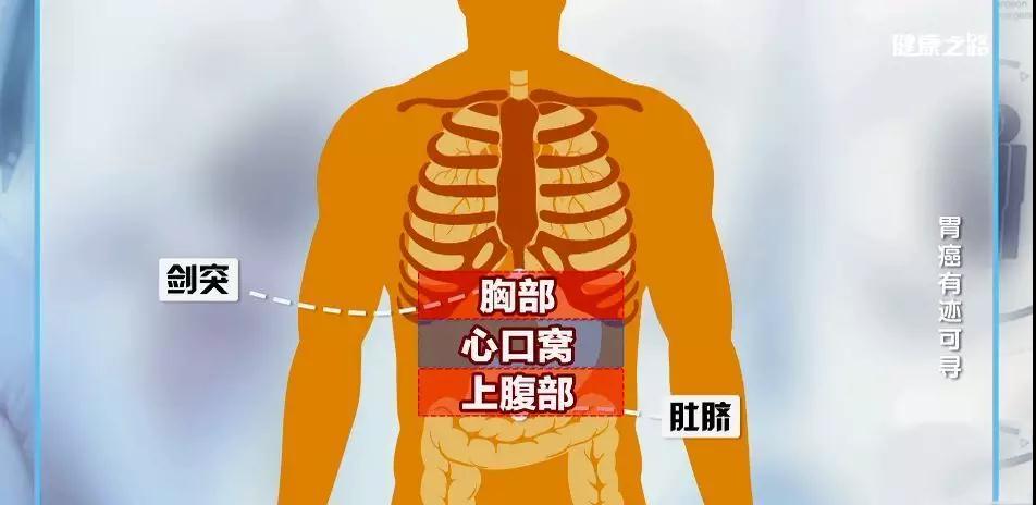 胃疼的部位分为:胸部疼,心口窝疼,上腹部疼.